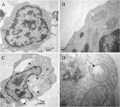 Neurotoxic Anatoxin-a Can Also Exert Immunotoxicity by the Induction of Apoptosis on Carassius auratus Lymphocytes in vitro When Exposed to Environmentally Relevant Concentrations